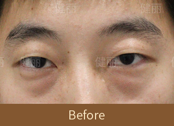 真實醫療案例 2 before